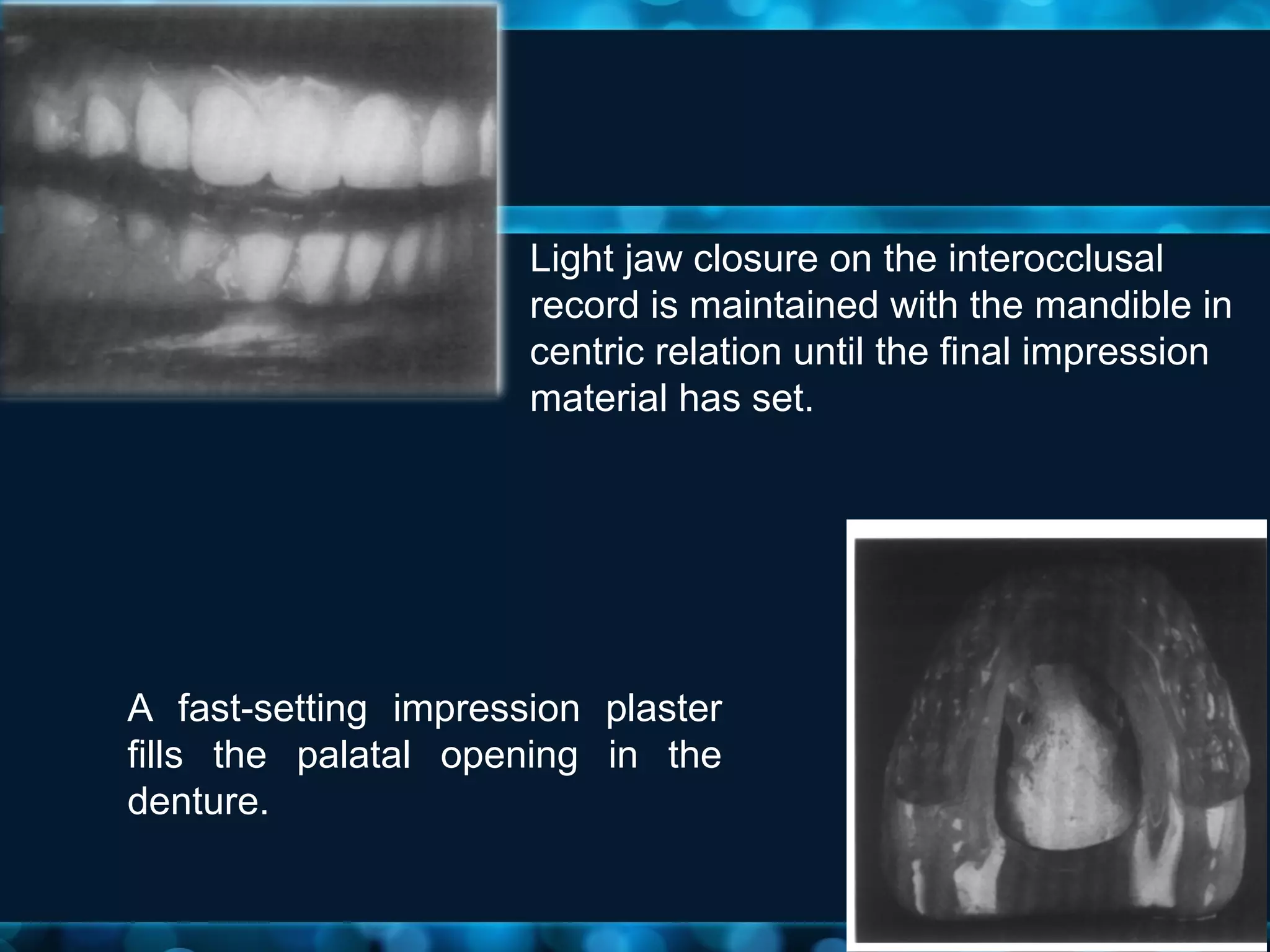 Relining and Rebasing | PPT