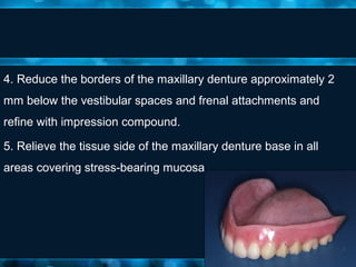 Relining and Rebasing | PPT