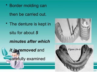 • Border molding can
then be carried out.
• The denture is kept in
situ for about 5
minutes after which
it is removed and
carefully examined
 