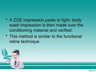 • A ZOE impression paste or light- body
wash impression is then made over the
conditioning material and verified.
• This method is similar to the functional
reline technique
 