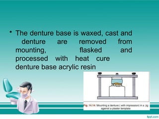 • The denture base is waxed, cast and
denture are removed from
mounting, flasked and
processed with heat cure
denture base acrylic resin
 