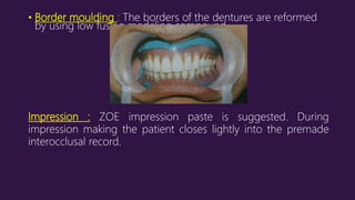 • Border moulding : The borders of the dentures are reformed
by using low fusing modeling compound.
Impression : ZOE impression paste is suggested. During
impression making the patient closes lightly into the premade
interocclusal record.
 