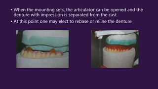• When the mounting sets, the articulator can be opened and the
denture with impression is separated from the cast
• At this point one may elect to rebase or reline the denture
 