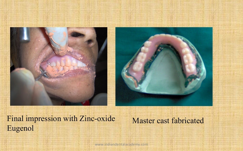 Relining and rebasing in complete dentures / Labial orthodontics cour…