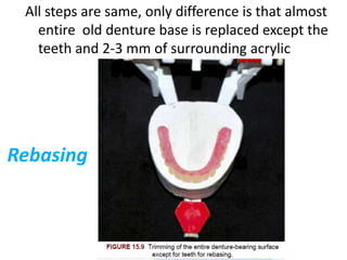 Rebasing
All steps are same, only difference is that almost
entire old denture base is replaced except the
teeth and 2-3 mm of surrounding acrylic
 