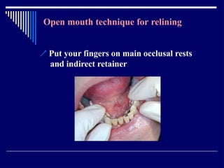 Relining In Rpd RELINING AND REPAIR OF RPD.pptxbhjyuijknbhgyuj | PPTX