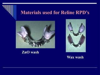 Relining In Rpd RELINING AND REPAIR OF RPD.pptxbhjyuijknbhgyuj | PPTX