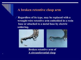 Relining In Rpd RELINING AND REPAIR OF RPD.pptxbhjyuijknbhgyuj | PPTX