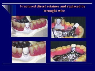 Relining In Rpd RELINING AND REPAIR OF RPD.pptxbhjyuijknbhgyuj | PPTX