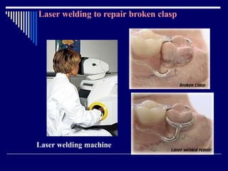 Relining In Rpd RELINING AND REPAIR OF RPD.pptxbhjyuijknbhgyuj | PPTX