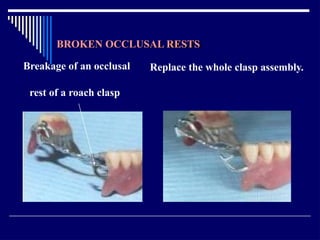 Relining In Rpd RELINING AND REPAIR OF RPD.pptxbhjyuijknbhgyuj | PPTX