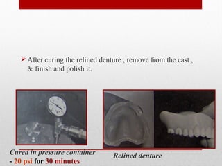 Relining & rebasing | PPT