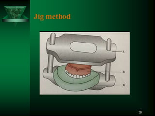 Jig method
29
 