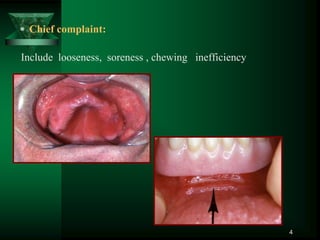  Chief complaint:
Include looseness, soreness , chewing inefficiency
4
 
