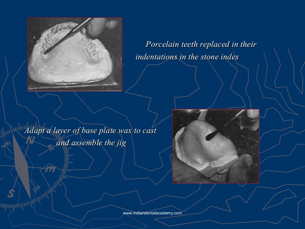 Relining rebasing and repair of complete denture/ dental courses