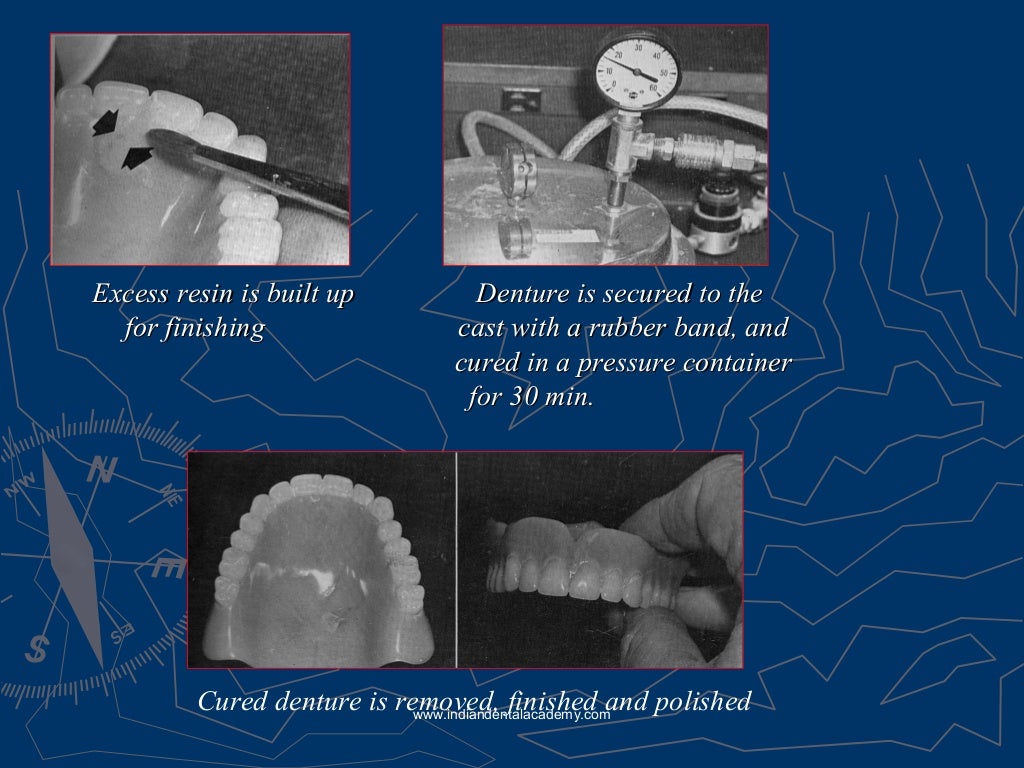 Relining rebasing and repair of complete denture/ dental courses