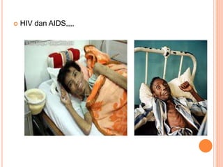  HIV dan AIDS,,,, 
 