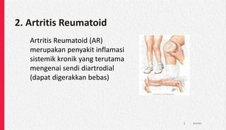 2. Artritis Reumatoid
Artritis Reumatoid (AR)
merupakan penyakit inflamasi
sistemik kronik yang terutama
mengenai sendi diartrodial
(dapat digerakkan bebas)
Artritis
1
 