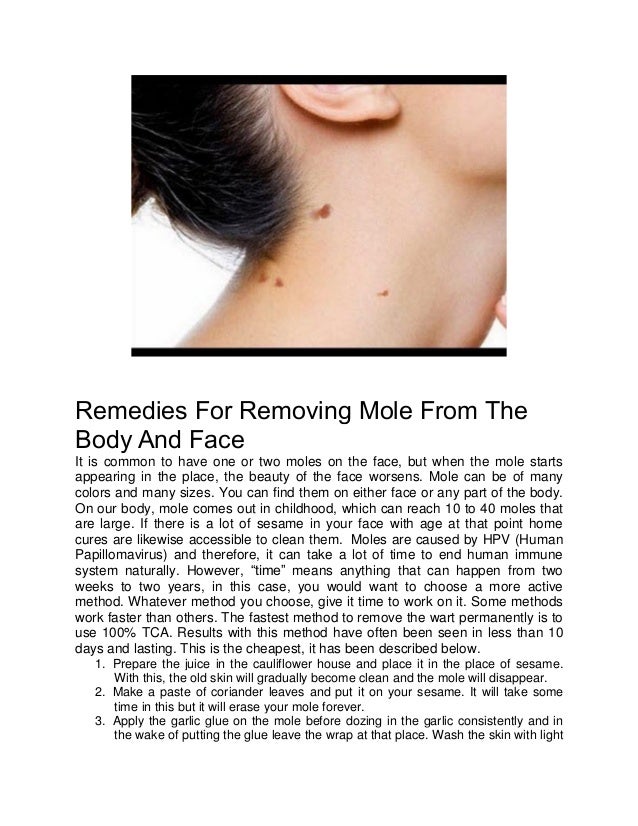 Remedies for removing mole from the body and face200