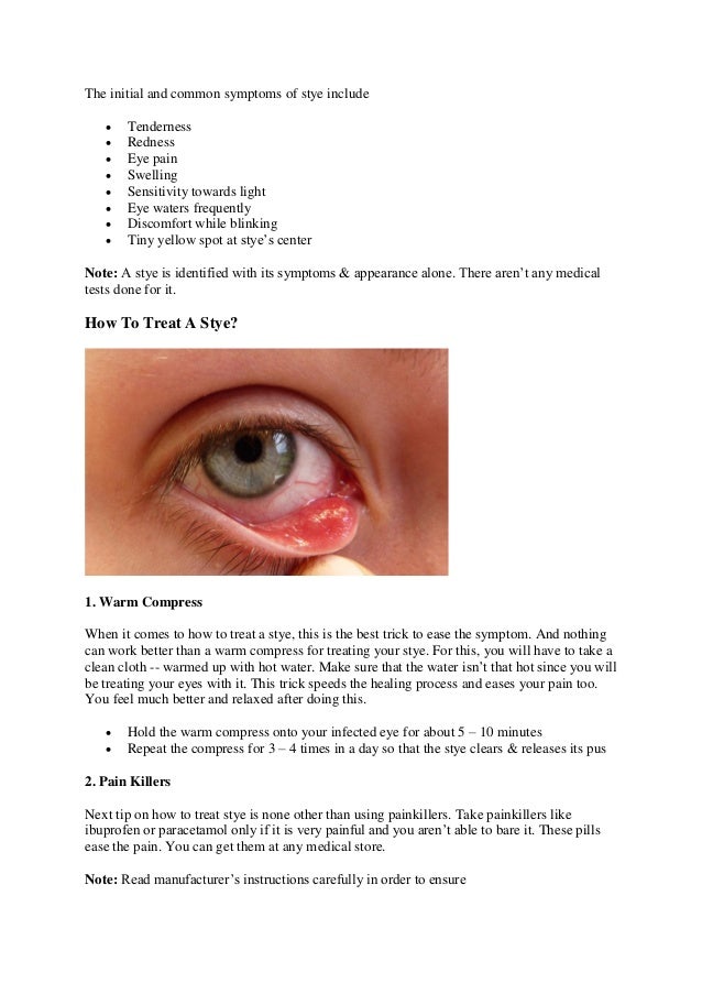 Remedies for stye