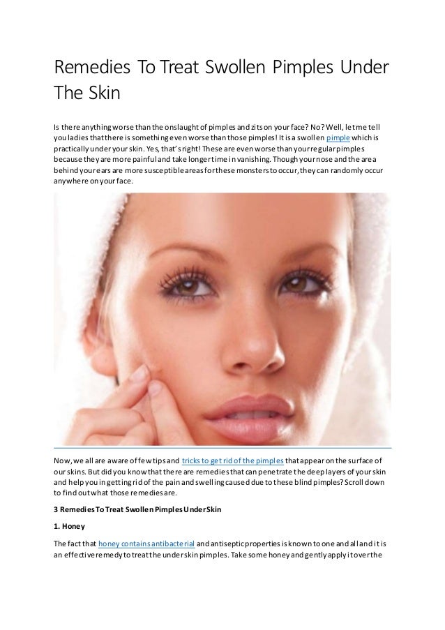 Remedies To Treat Swollen Pimples Under The Skin