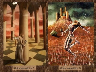 Dolor reumático I Dolor reumático II 