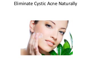 Eliminate Cystic Acne Naturally
 