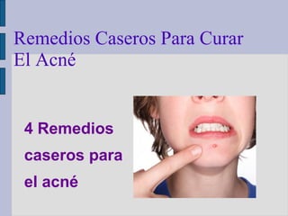 Remedios Caseros Para Curar
El Acné

4 Remedios
caseros para
el acné

 