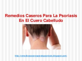 http://remedioscaserosparalapsoriasis.blogspot.com/
Remedios Caseros Para La Psoriasis
En El Cuero Cabelludo
 