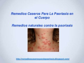 Remedios Caseros Para La Psoriasis en
el Cuerpo
Remedios naturales contra la psoriasis
http://remedioscaserosparalapsoriasis.blogspot.com/
 
