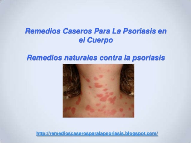 El tratamiento de la psoriasis intramuscular por los preparados