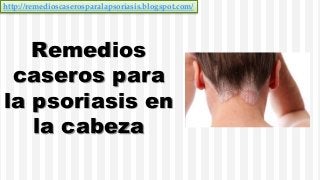 http://remedioscaserosparalapsoriasis.blogspot.com/
Remedios
caseros para
la psoriasis en
la cabeza
 