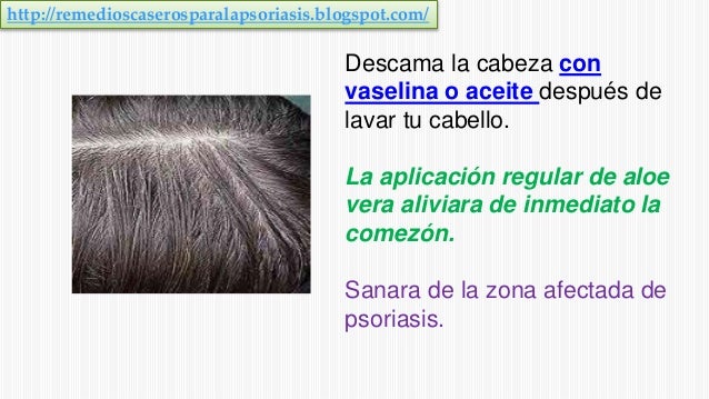 La psoriasis la invalidez que grupo