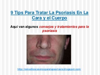 9 Tips Para Tratar La Psoriasis En La
Cara y el Cuerpo
Aquí van algunos consejos y tratamientos para la
psoriasis
http://remedioscaserosparalapsoriasis.blogspot.com/
 