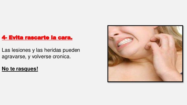 Remedios caseros para la  psoriasis en la  cara  