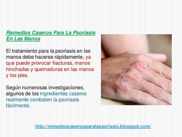 El medio para las uñas a la psoriasis
