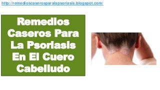 http://remedioscaserosparalapsoriasis.blogspot.com/
Remedios
Caseros Para
La Psoriasis
En El Cuero
Cabelludo
 
