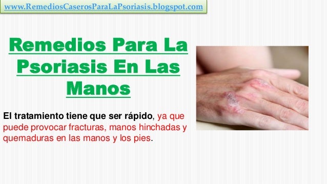 La depuración del hígado a la psoriasis