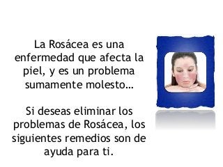 La Rosácea es una 
enfermedad que afecta la 
piel, y es un problema 
sumamente molesto… 
Si deseas eliminar los 
problemas de Rosácea, los 
siguientes remedios son de 
ayuda para ti. 
 