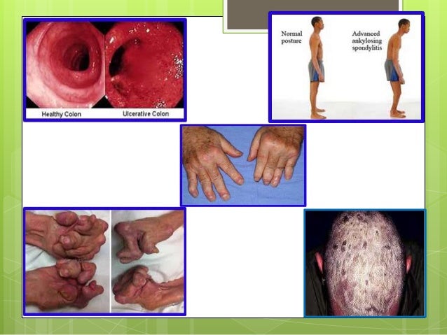 Remicade presentation Remicade presentation