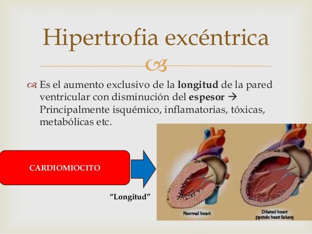 El ungüento que aumenta el pene