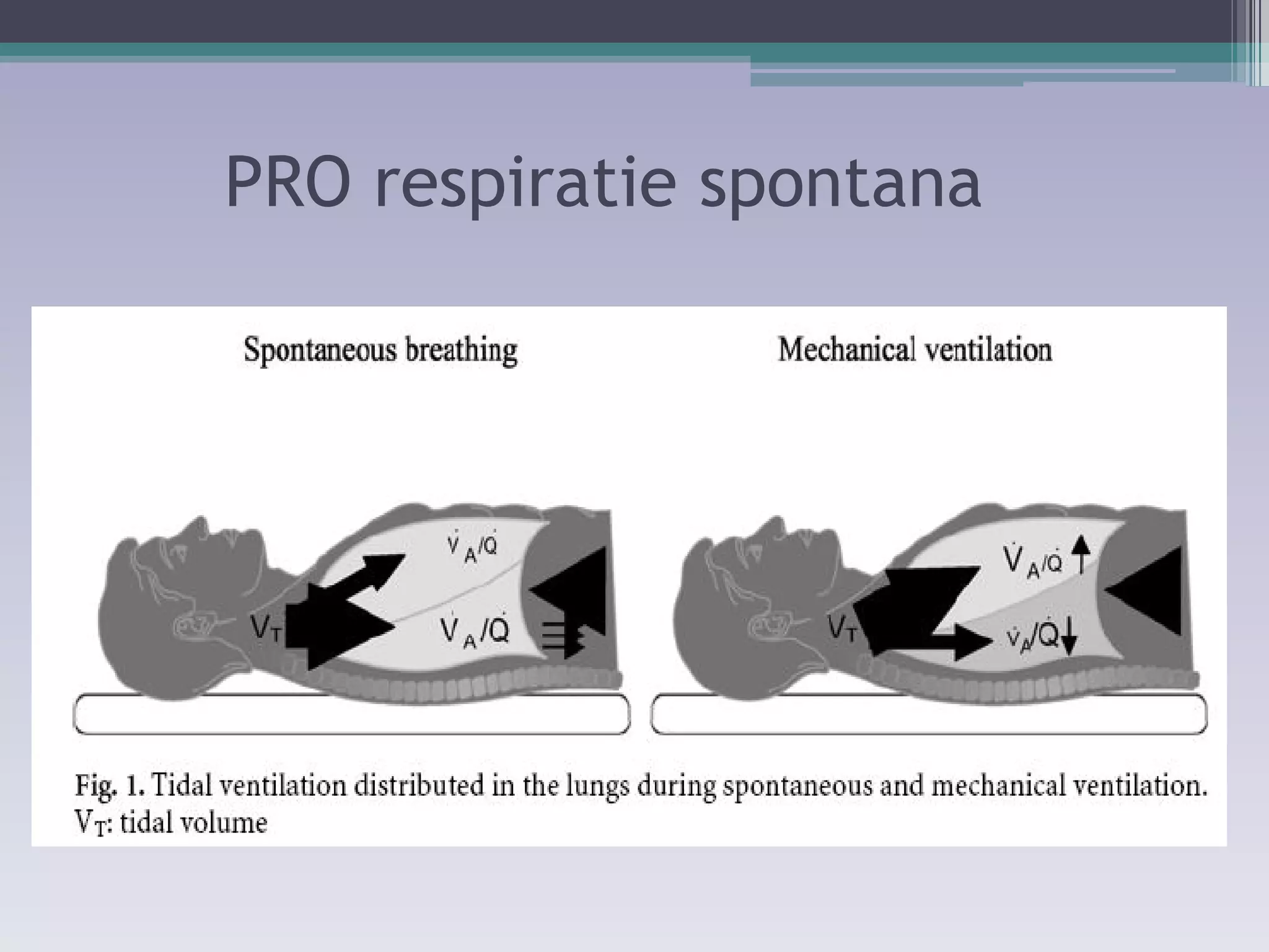 PRO respiratie spontana 
 