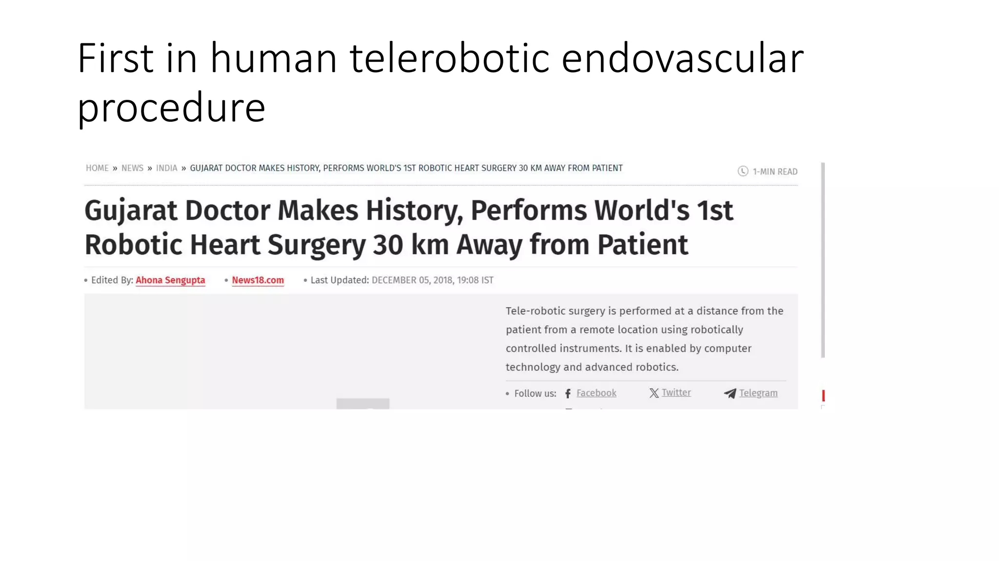 First in human telerobotic endovascular
procedure
 