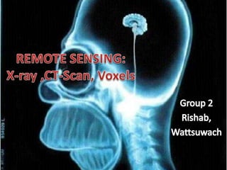 REMOTE SENSING: X-ray ,CT-Scan, Voxels Group 2 Rishab,  Wattsuwach 