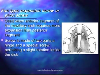 Fan type expansion screw orFan type expansion screw or
pivot screwpivot screw
 Used when anterior segment ofUsed when anterior segment of
the maxillary arch requires morethe maxillary arch requires more
expansion than posteriorexpansion than posterior
segmentsegment
 Screw is made of two parts,aScrew is made of two parts,a
hinge and a special screwhinge and a special screw
permitting a slight rotation insidepermitting a slight rotation inside
the diskthe disk
www.indiandentalacademy.com
 