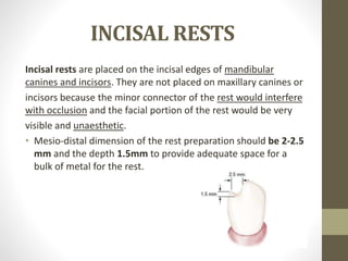 Preparation of the mouth for removable partial denture | PPTX