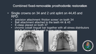removable-partial-denture-f-f.pptx