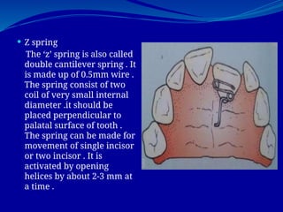 removable appliance third year bds presentation | PPT