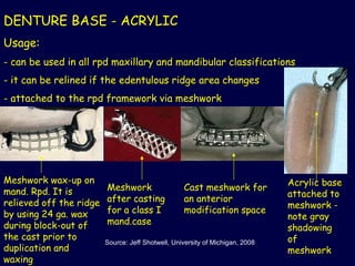 Comprehensive Classification and Components of Removable Partial ...