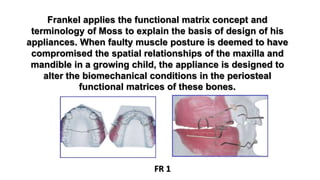 Frankel applies the functional matrix concept and
terminology of Moss to explain the basis of design of his
appliances. When faulty muscle posture is deemed to have
compromised the spatial relationships of the maxilla and
mandible in a growing child, the appliance is designed to
alter the biomechanical conditions in the periosteal
functional matrices of these bones.
FR 1
 